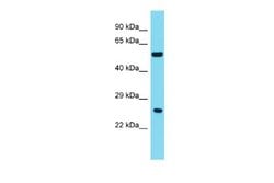 ANKRD18A Antibody, Novus Biologicals 100 &mu;L | Buy Online | Novus Biologicals | Fisher Scientific